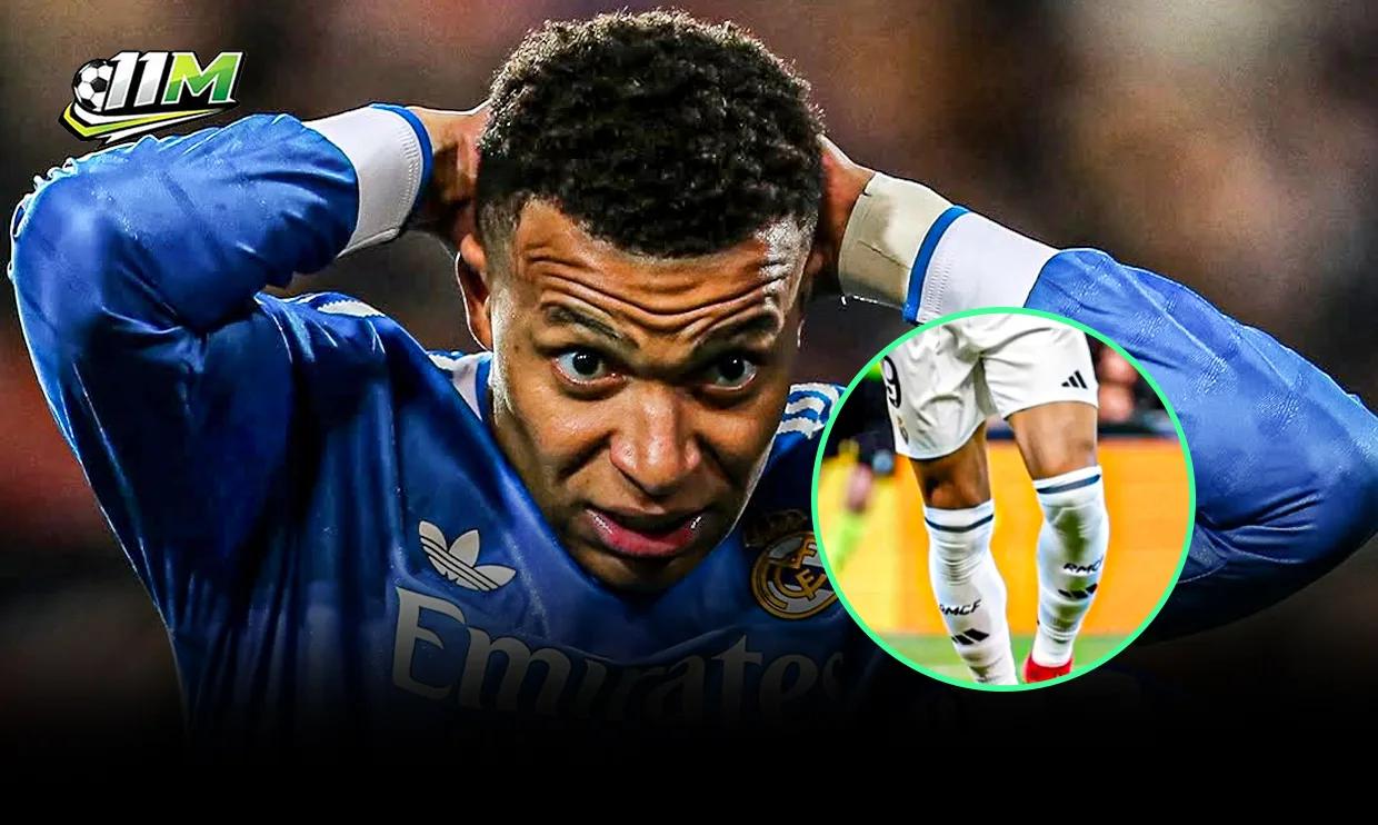 "Cú lừa" y tế chấn động Real Madrid: Kylian Mbappe chấn thương vì sai lầm của đội ngũ y tế