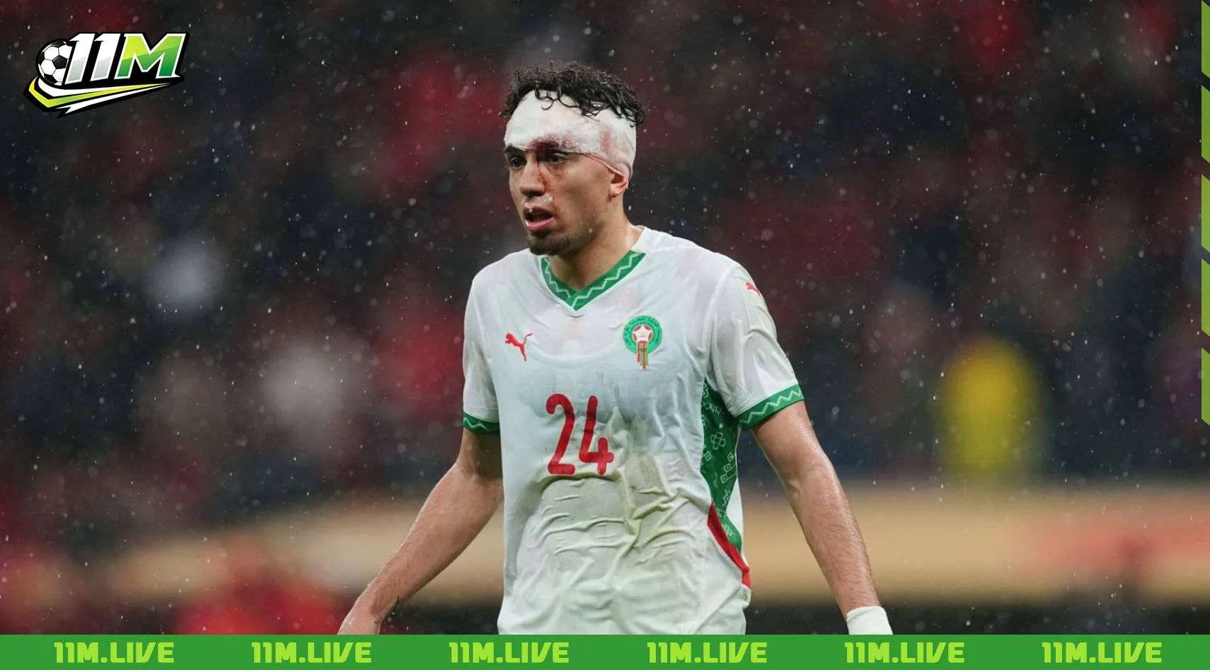 Neil El Aynaoui